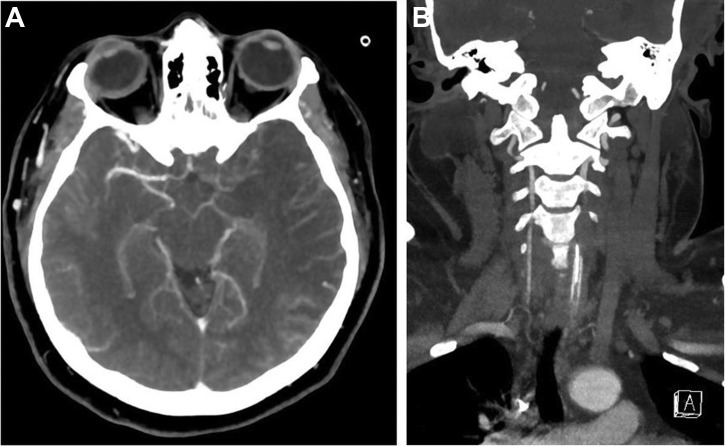 Figure 2