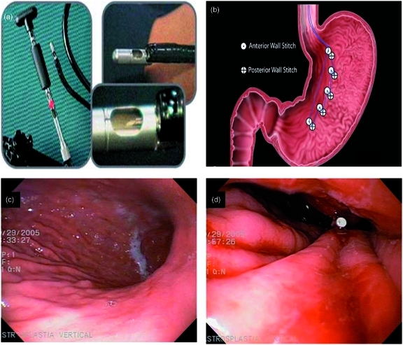 Figure 1.