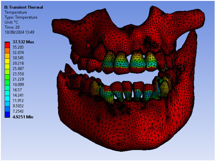 Figure 35