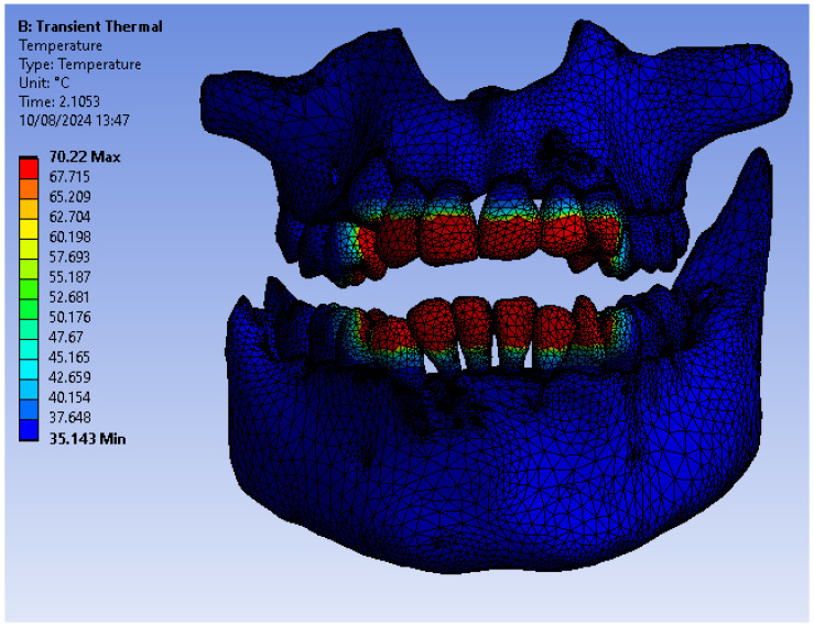 Figure 25