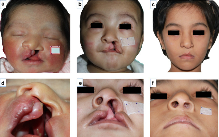 Fig. 3