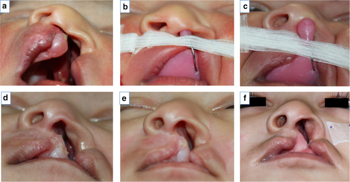 Fig. 2