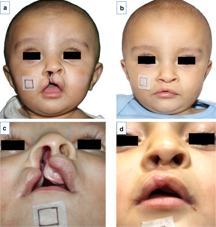 Fig. 7