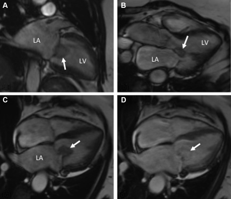 Figure 2