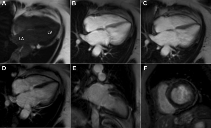 Figure 3