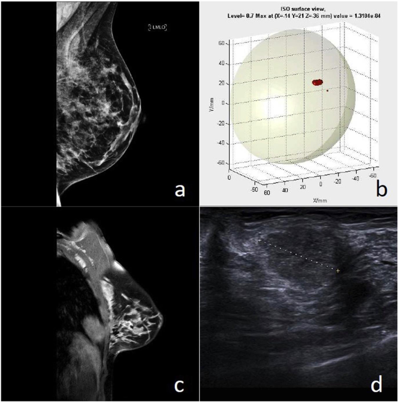 Figure 12