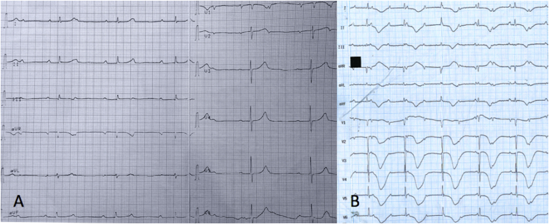 Fig. 1