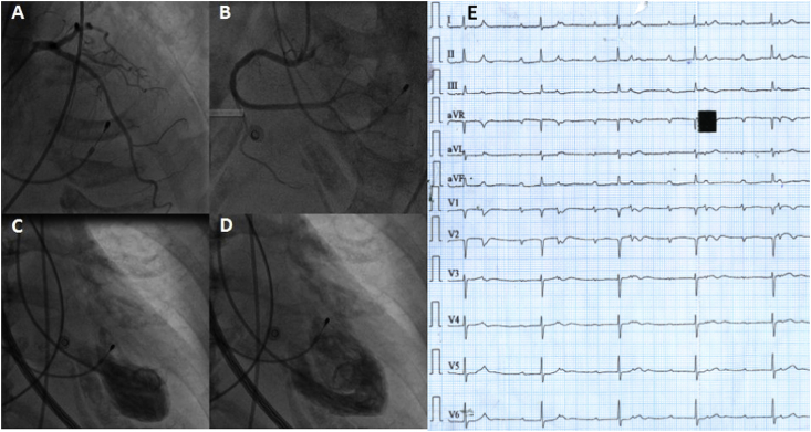 Fig. 2