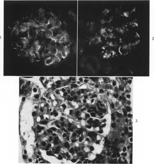 Fig 1-3