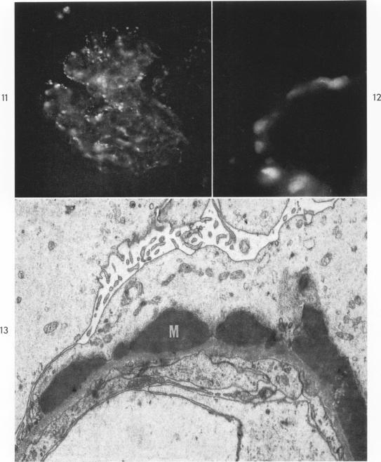 Fig 11-13