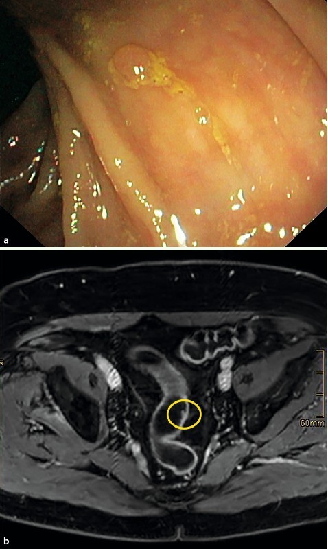 Fig. 1 a