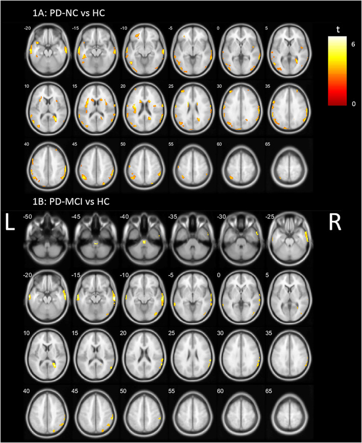 FIG. 1