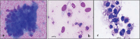 FIGURE 1 -