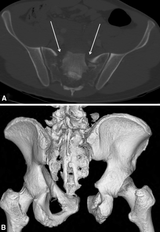 Fig. 2A–B