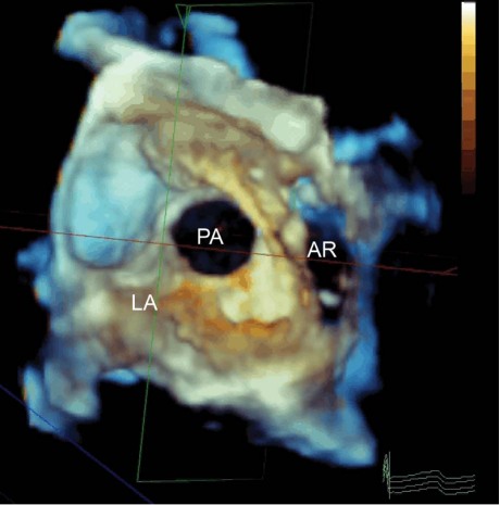 graphic file with name 37FF2.jpg