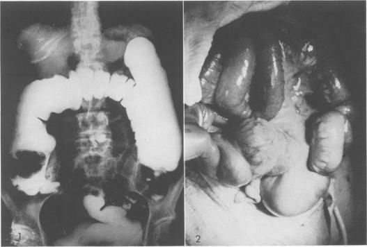 Fig. 1., Fig. 2.