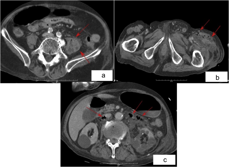 Fig. 1