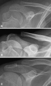 Fig. 2A–C