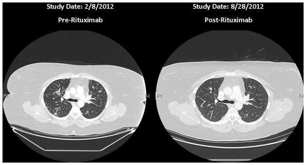 FIG 4