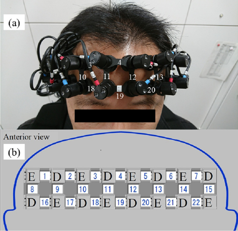 Fig 3