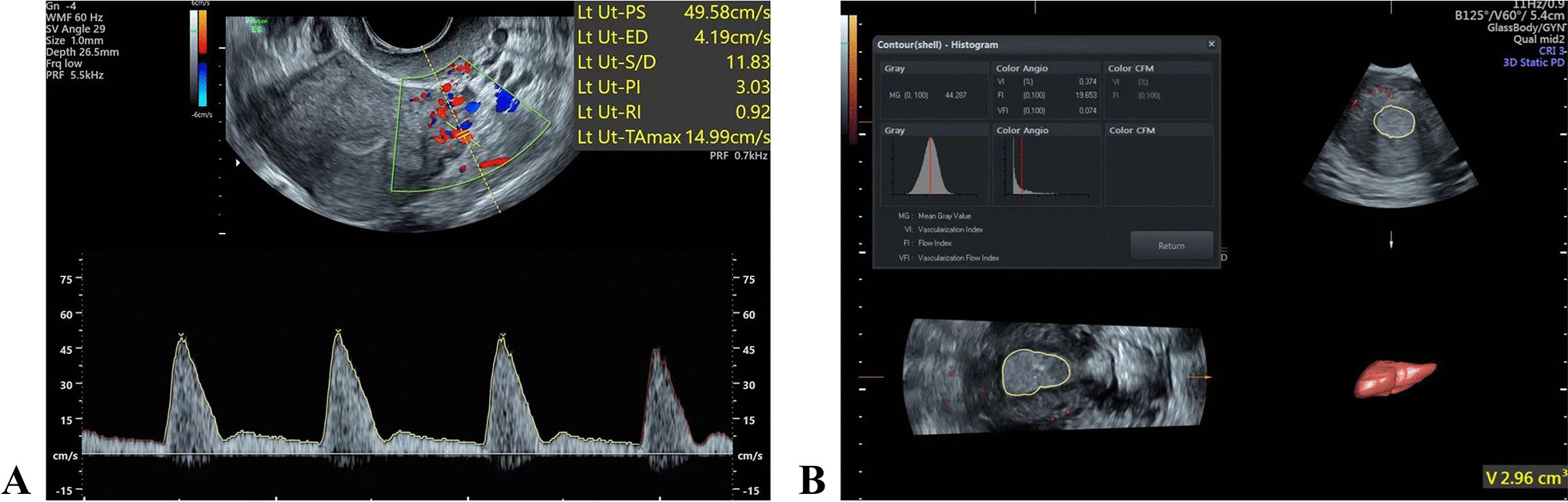 Fig. 2