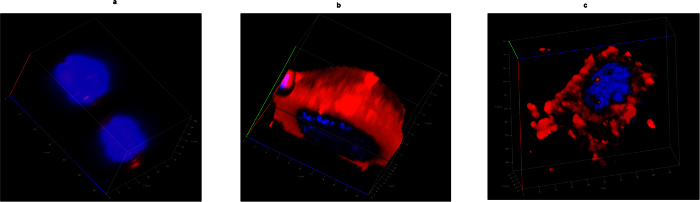 Figure 11