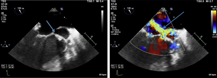 Figure 4