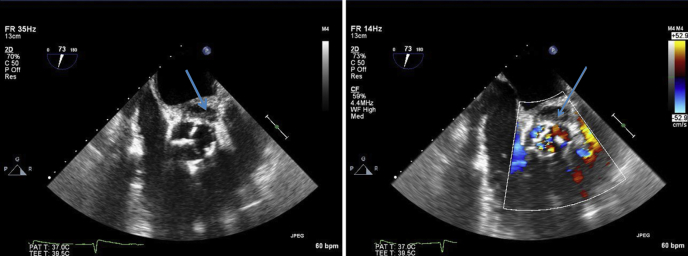 Figure 2