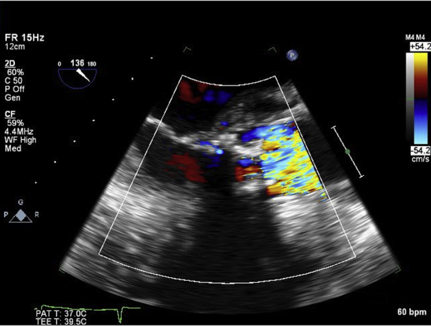 Figure 3