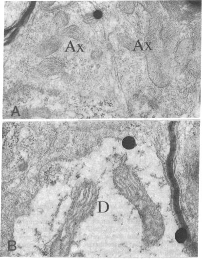 graphic file with name pnas00018-0445-a.jpg