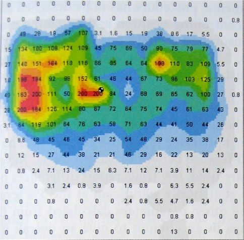 Fig. 1