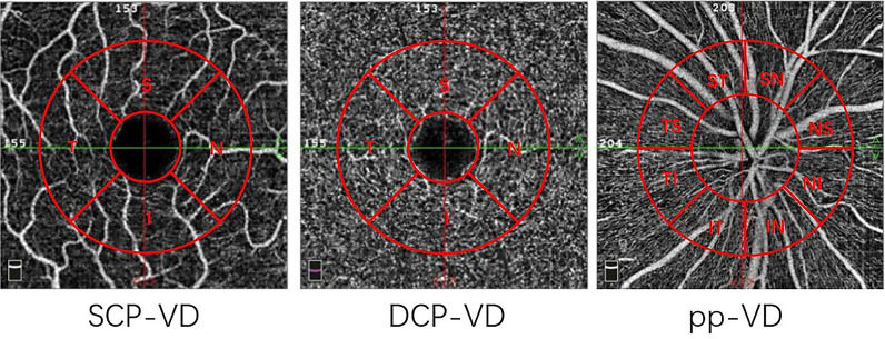 Fig. 1