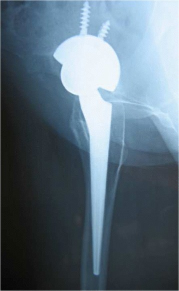 Fig. 6