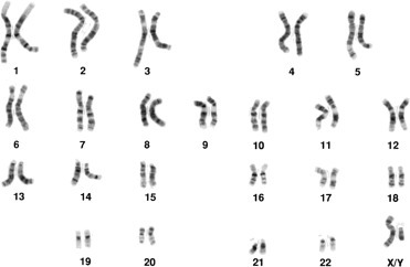 Figure 3.9