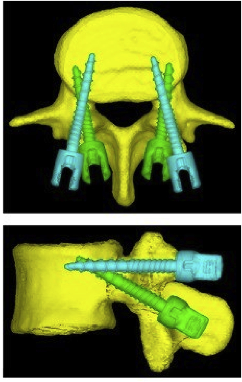 Fig. 4