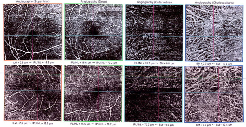 Fig. 3