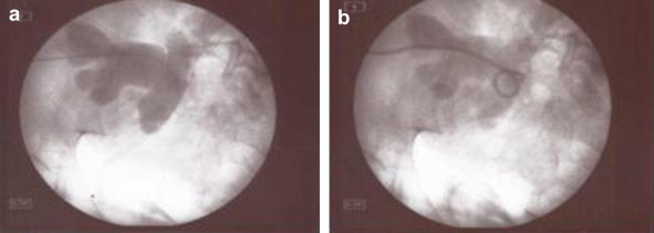 Fig. 5