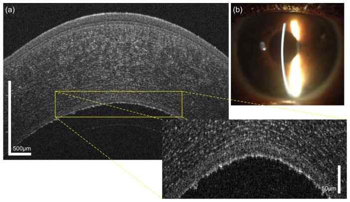 Fig. 12