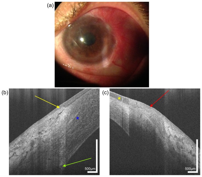 Fig. 6