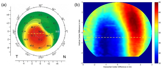 Fig. 11