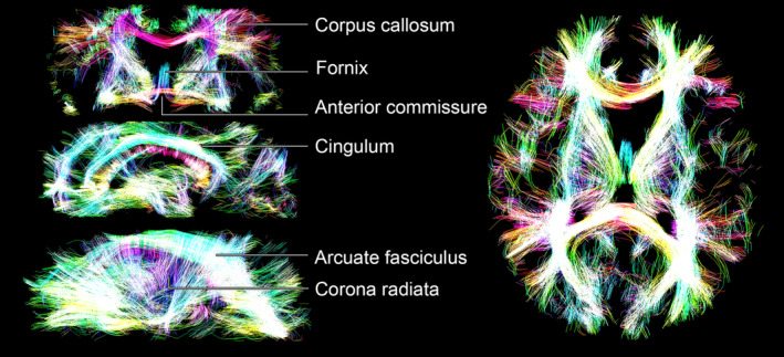 FIGURE 5