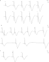 Fig 7