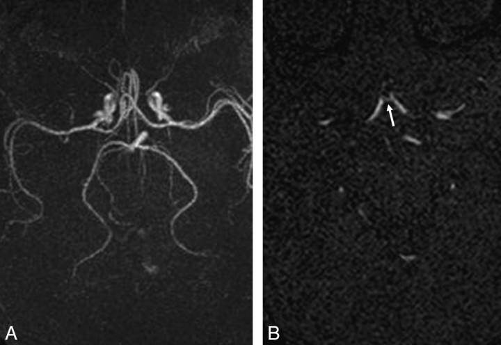 Fig 3.