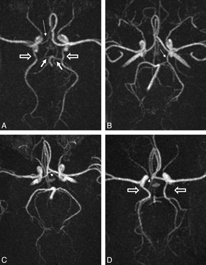 Fig 2.