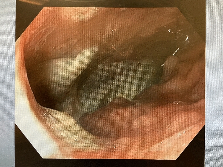 graphic file with name 464_2023_10072_Figea_HTML.jpg