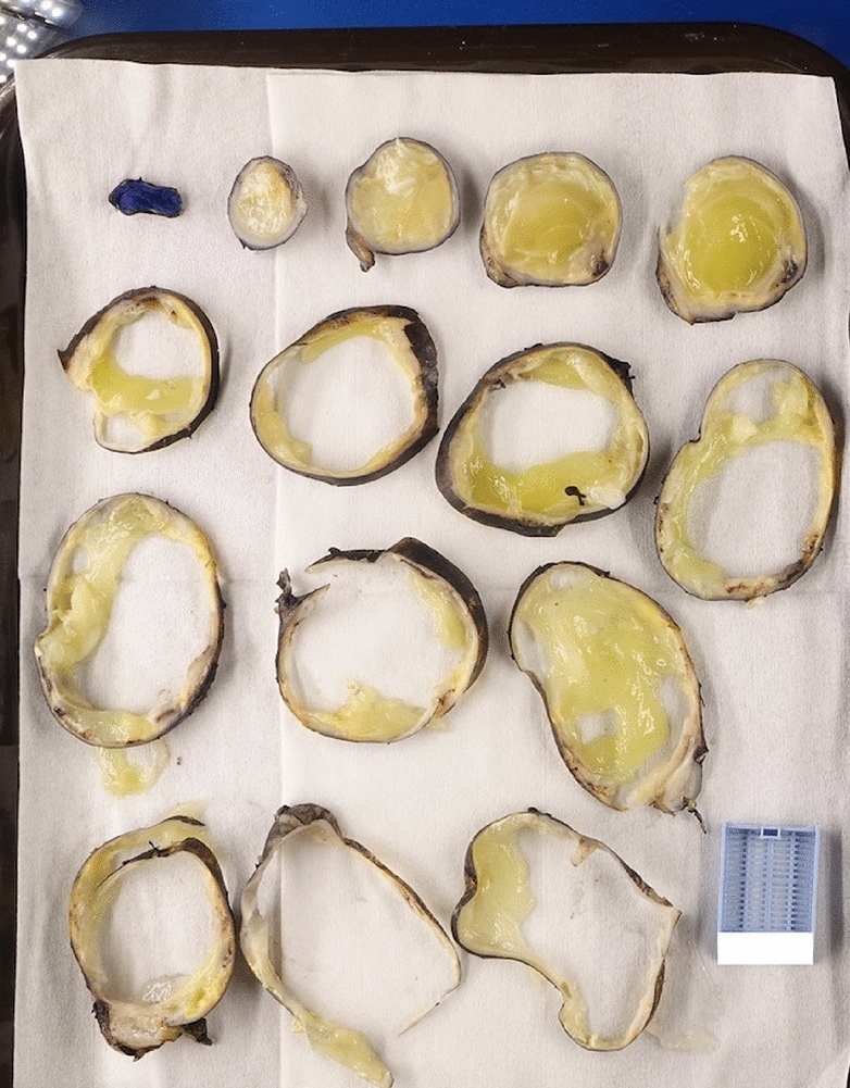 graphic file with name 464_2023_10072_Figfn_HTML.jpg