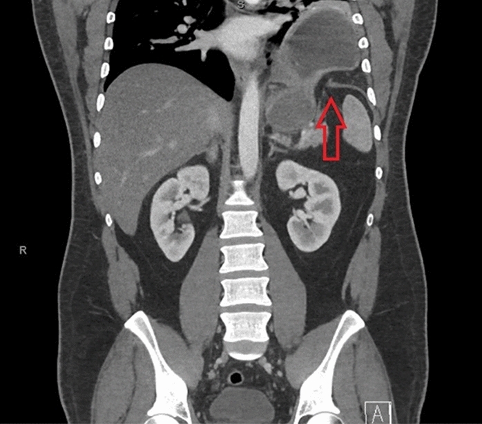 graphic file with name 464_2023_10072_Figgx_HTML.jpg