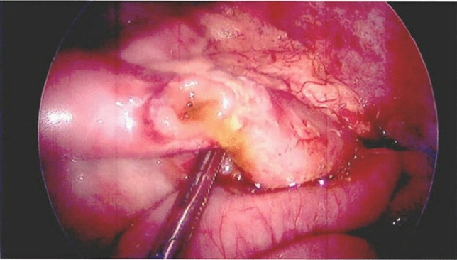 graphic file with name 464_2023_10072_Figfk_HTML.jpg