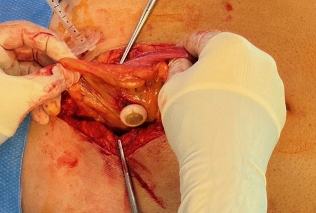 graphic file with name 464_2023_10072_Figl_HTML.jpg