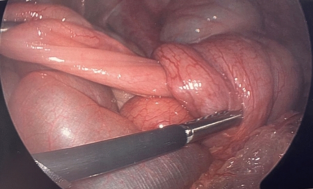 graphic file with name 464_2023_10072_Figw_HTML.jpg